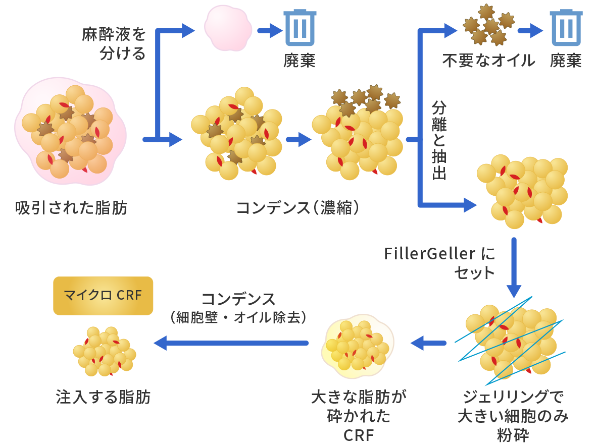 マイクロCRFとは