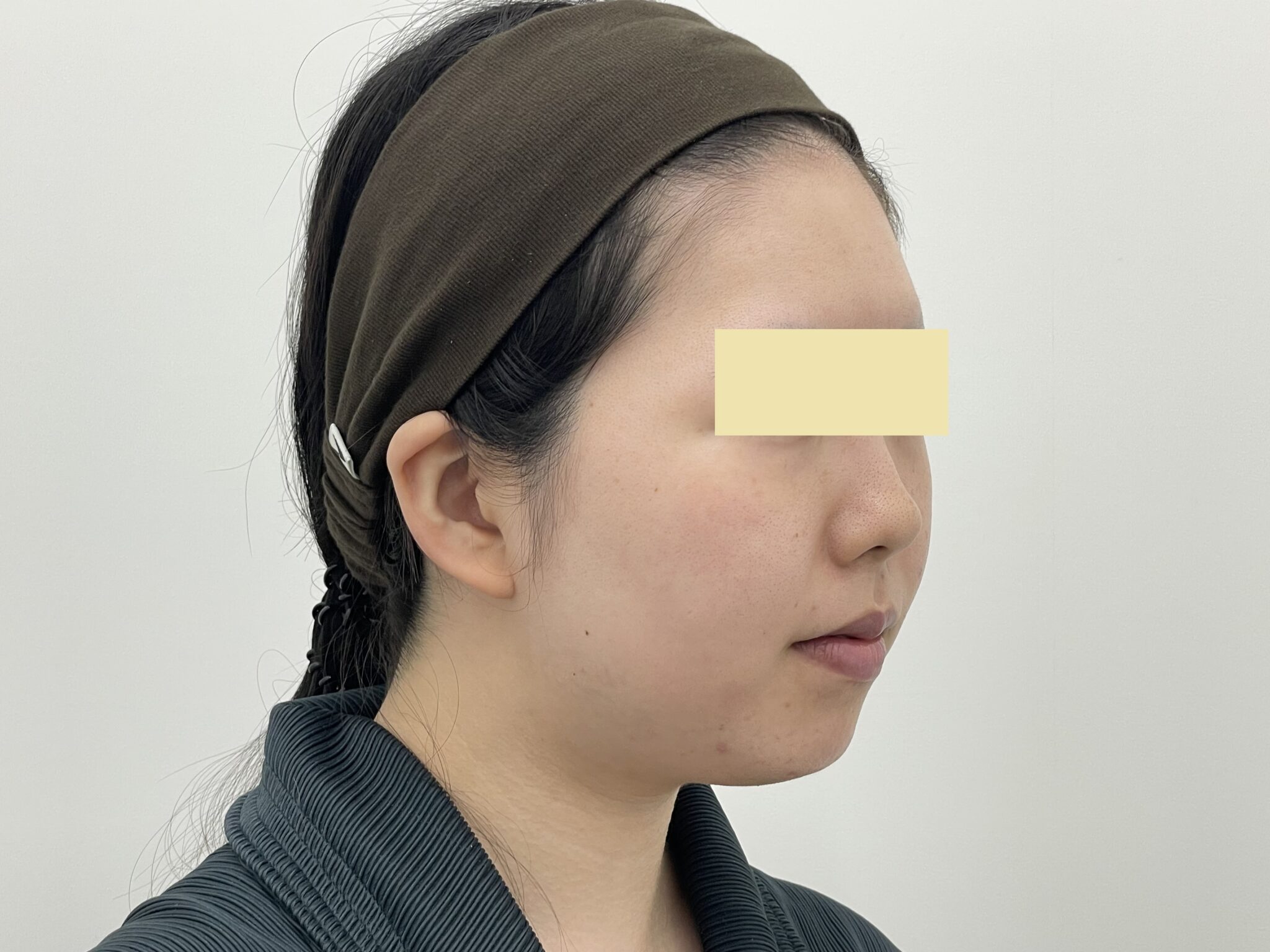施術前