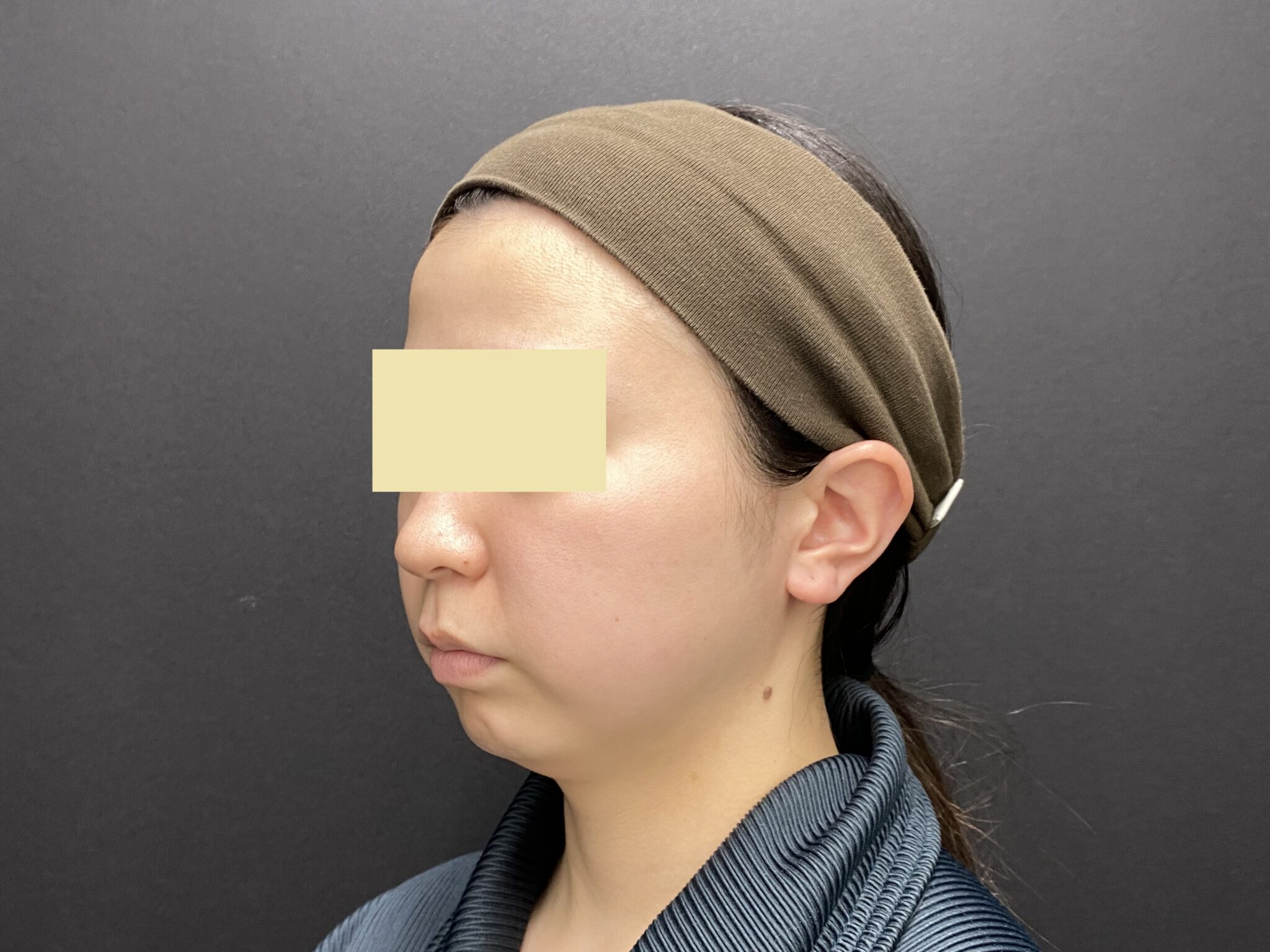 施術前