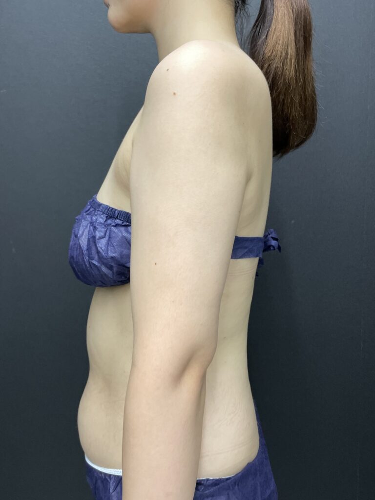 施術後