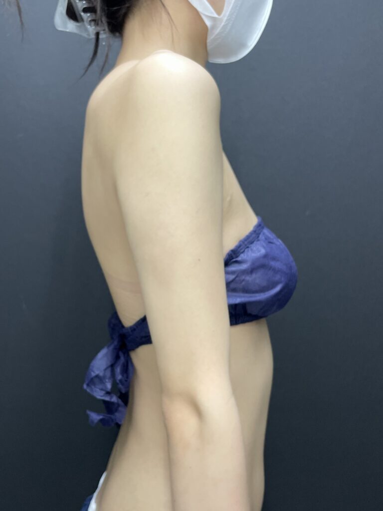 施術後
